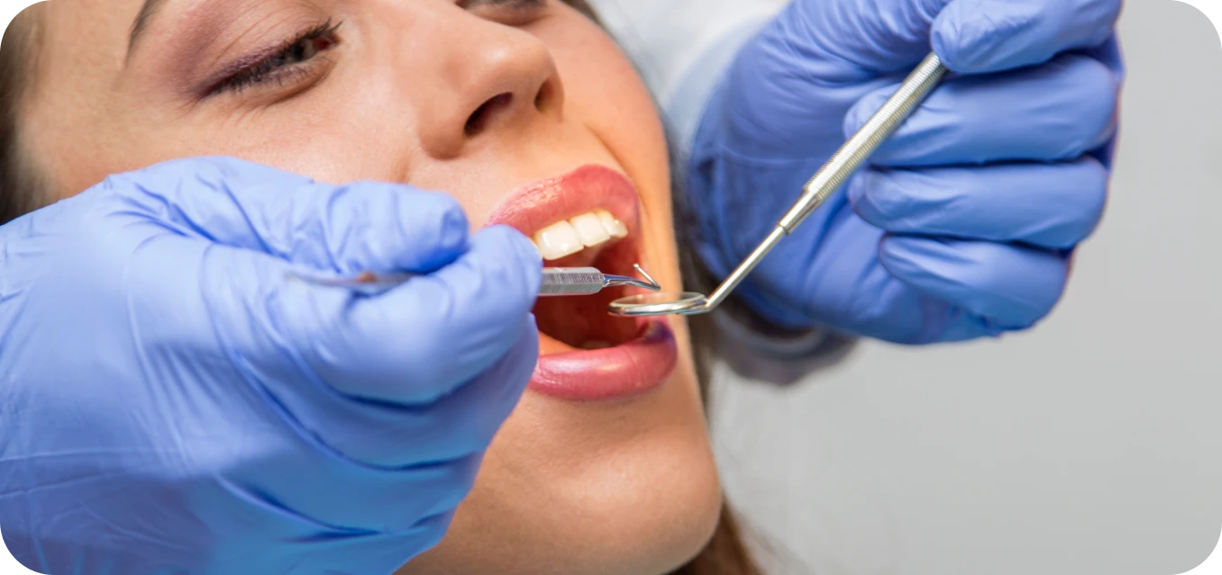 Limpieza dental profesional