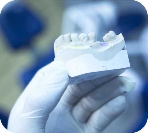 Prótesis dentales a tu medida